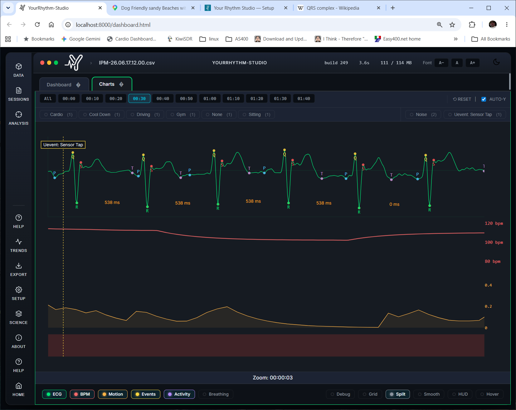 ECG Deep Dive