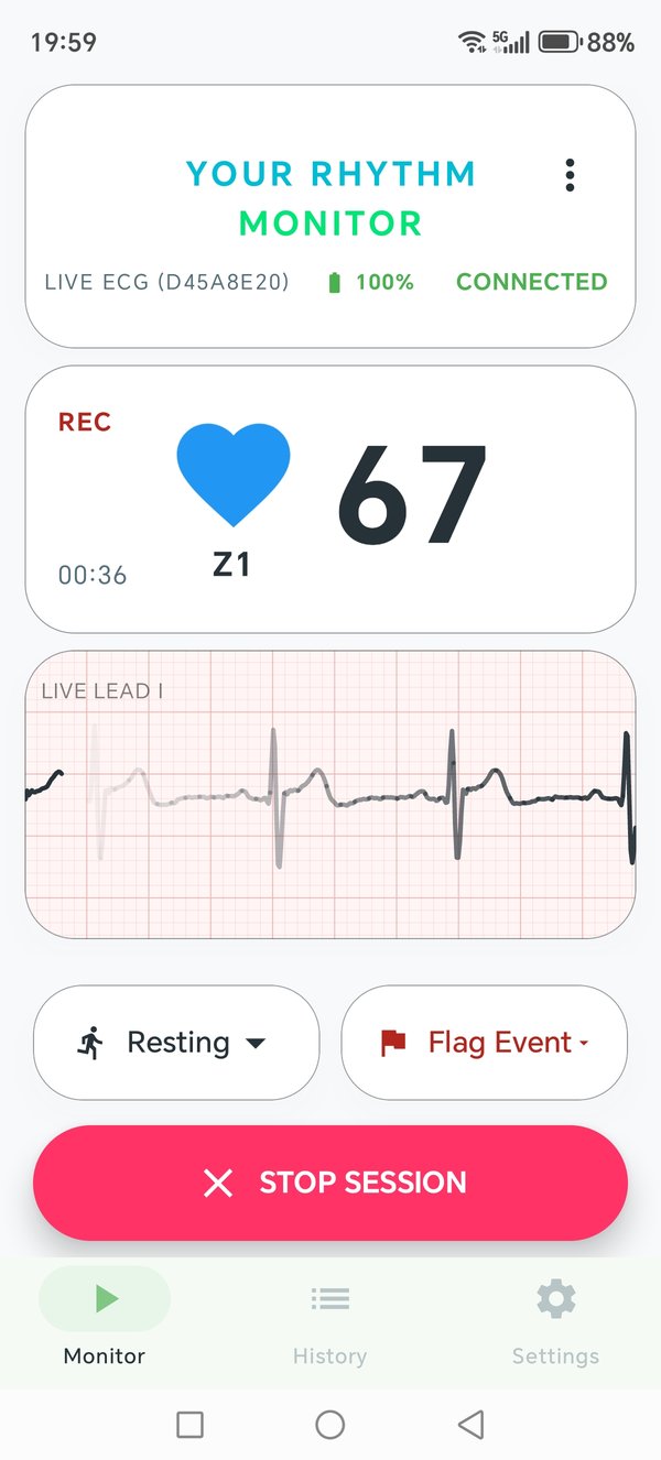 Live ECG capture