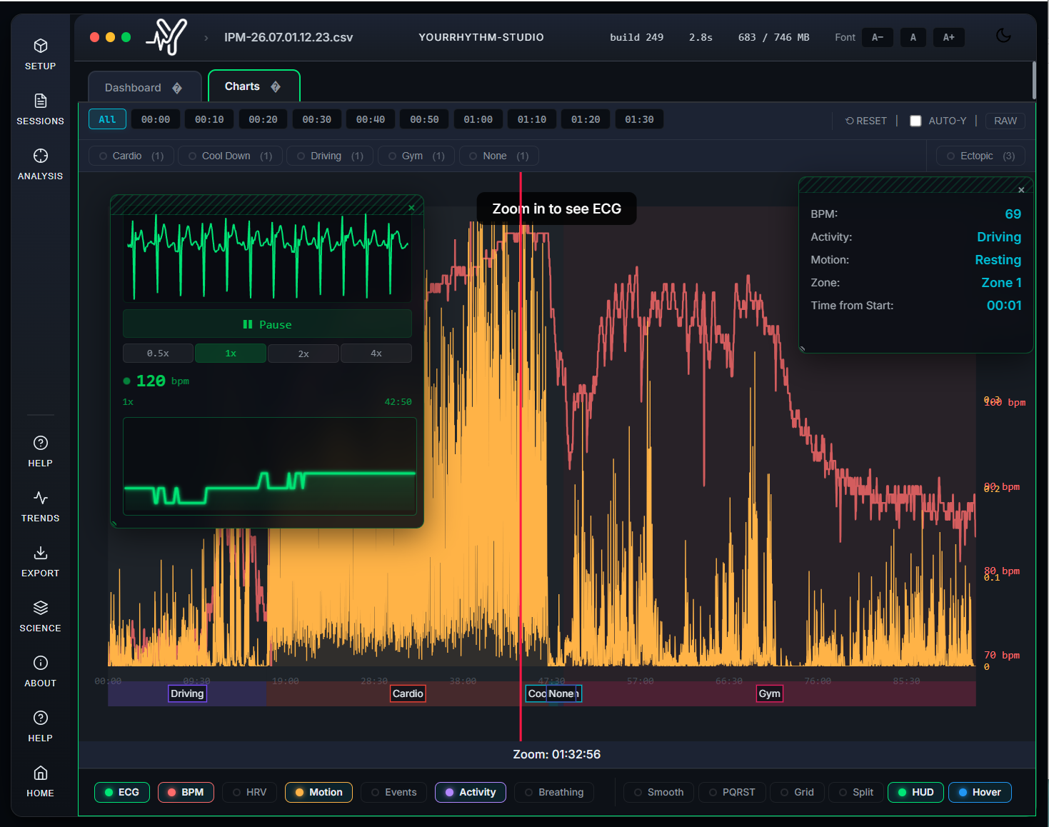 Charts tab: full-session ECG, BPM and activity overlay